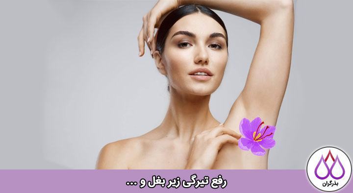 رفع تیرگی نواحی تناسلی